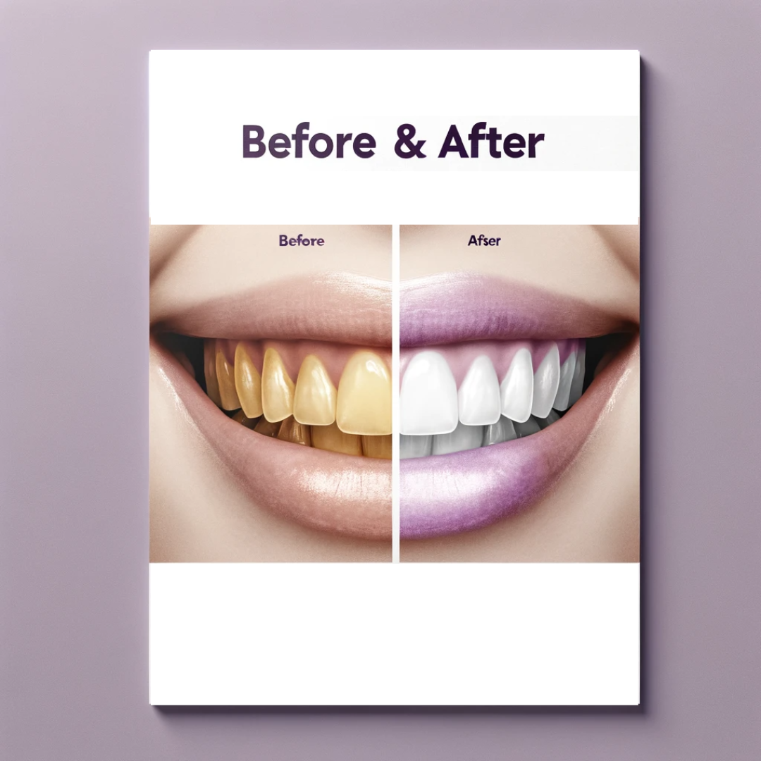SMILEKIT™ V34 Teeth Whitening Booster, Colour Corrector